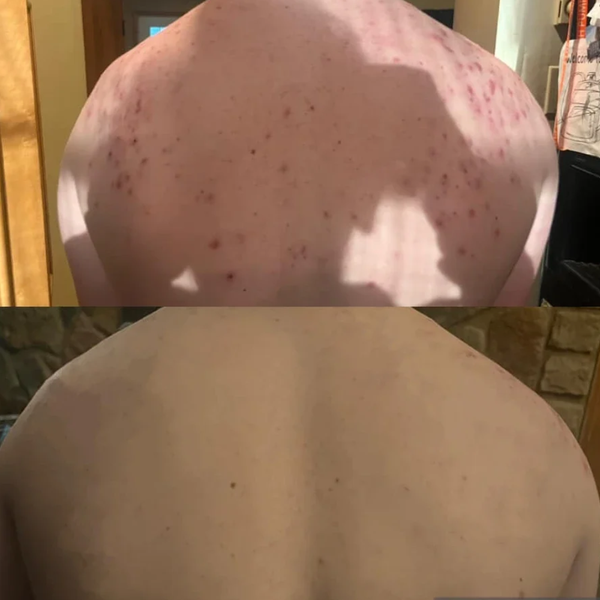 Customer result