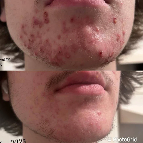 Customer result