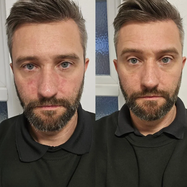 Customer result
