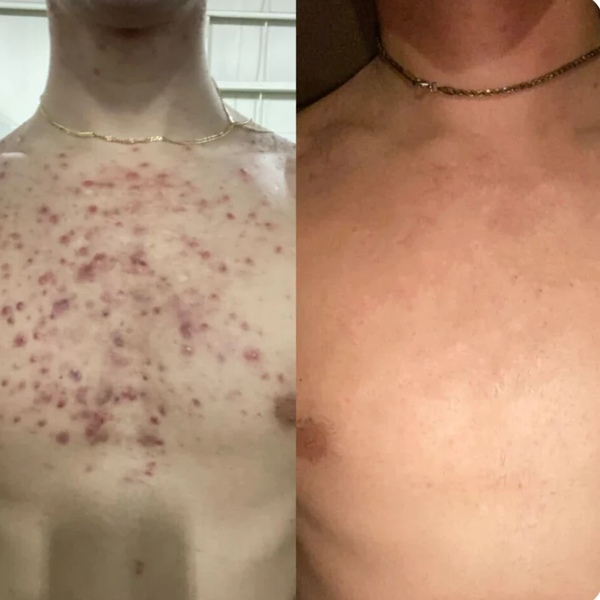 Customer result